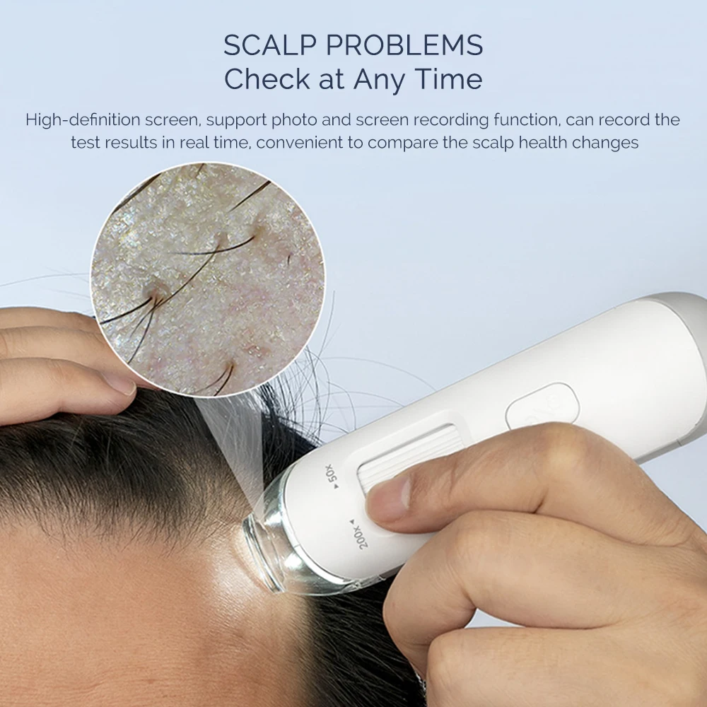 Portable Hair Follicle Scalp Detector 50X/200X Magnifying Pore Magnifier Mini Skin And Hair Eetector Skin Analyzer Skin Tester