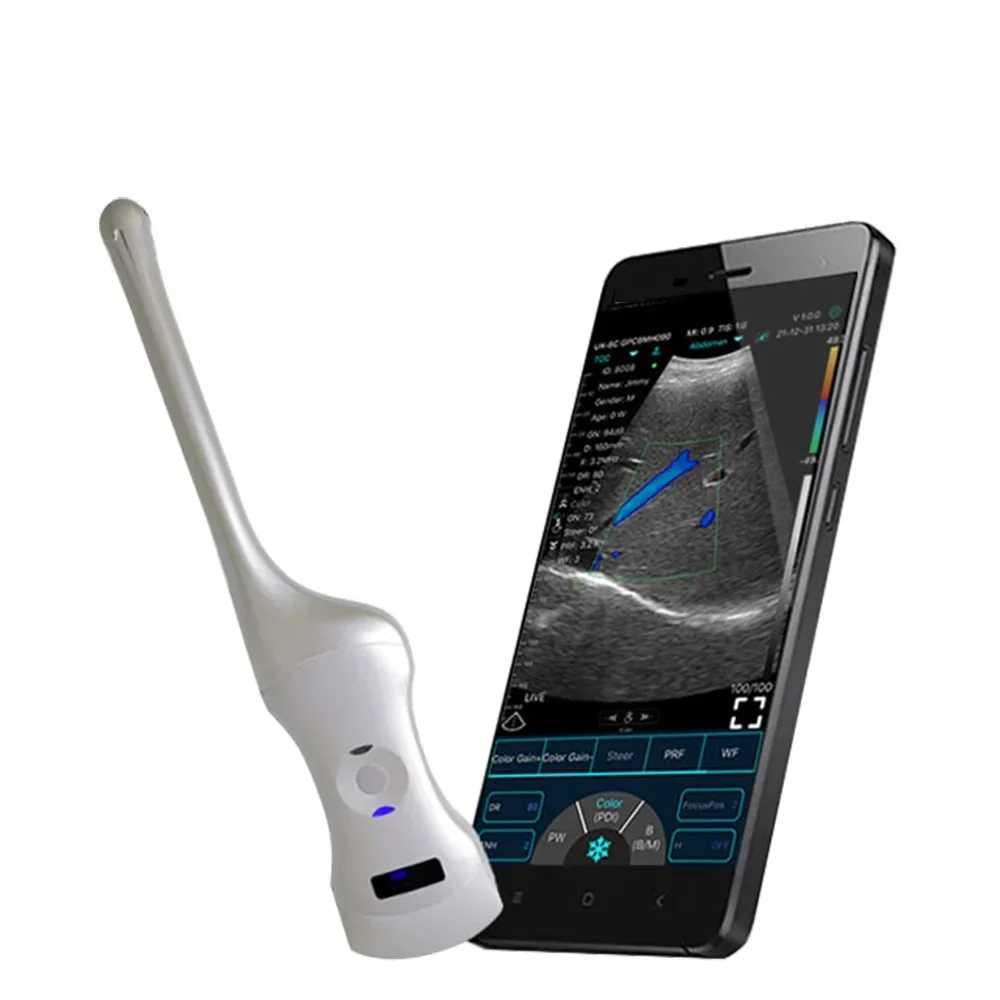 

Dual-Probes Multipurpose 192 Matriz Ultrasound Convex+Endocavity+Cardiac Probe