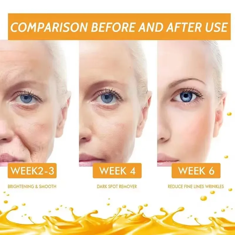 Vitamin C Whitening Serum Face Remove Dark Spots Freckles Fade Melanin Retinol Anti-wrinkle Essence Brightening Korean Skin Care 5