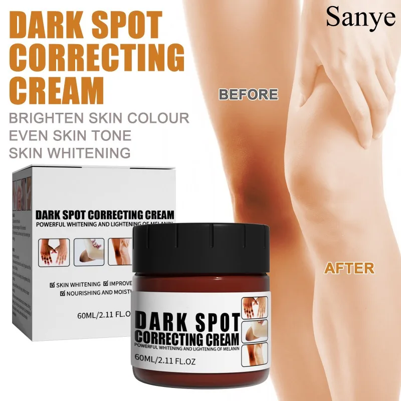 Whitening Intimate Area Body Cream Underarm Whiten Essence Knee Butt Dullness Brighten Cream Improve Dark Skin Moisturize Care