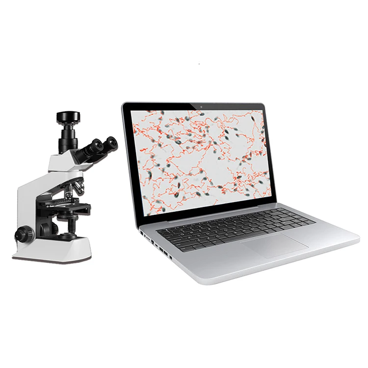 

15 inches Laptop Semen quality Analysis automated sperm analyzer