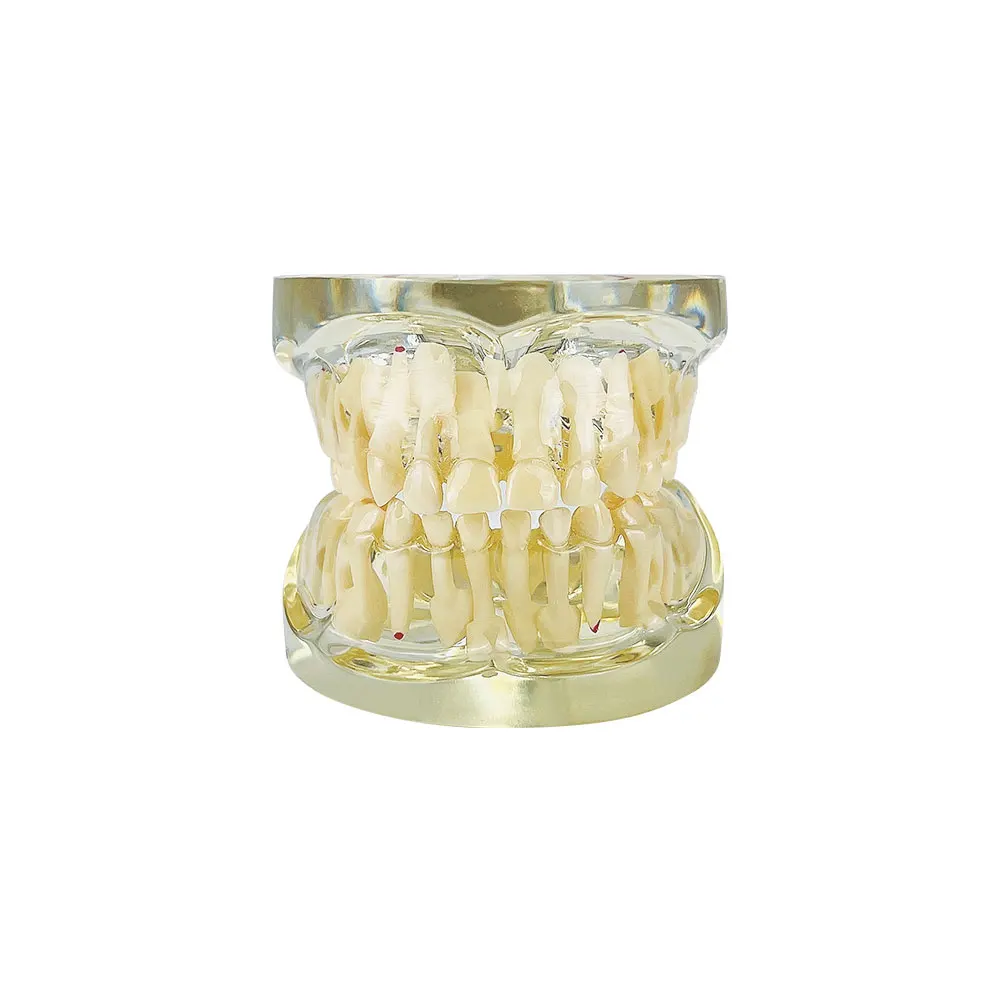 modèle dentaire pour dents primaires en étude de dentiste avec outils de démonstration fuchsia
