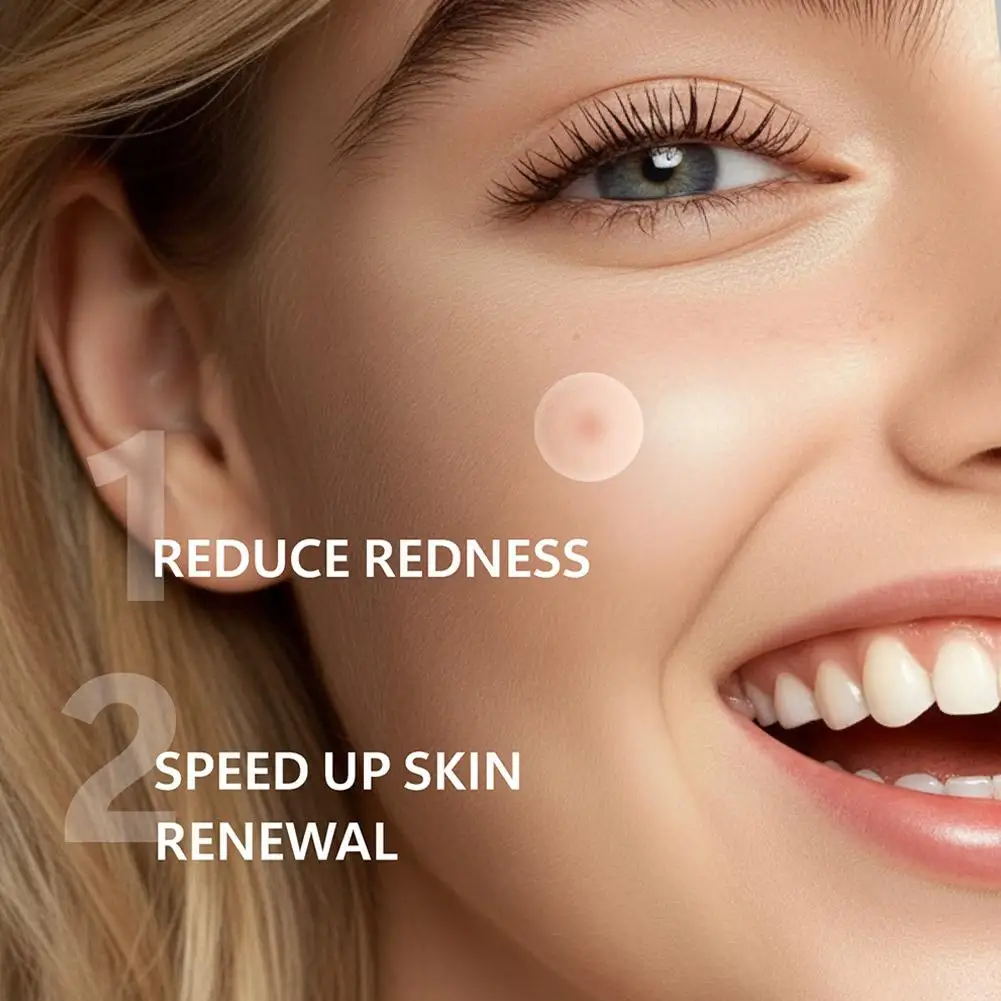 Hydrocolloid Round Pimple Patch Ultra-thin Invisible Micro Needle Acne Patches 8 Hours Effective Facial Care Acne Cover Sticker