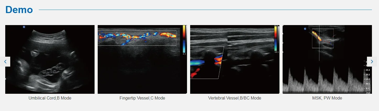 Рисунок 2 - Больничный допплер Chison QBit на 3 тележках