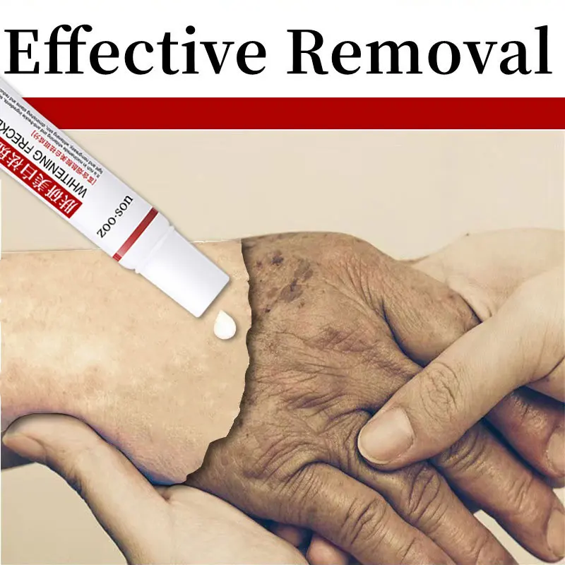 

Whitening Freckle Cream NicotinamideRemove Melasma Dark Spots Melanin Brighten Anti-Aging Lightening Shrink Pores FaceSkin Care