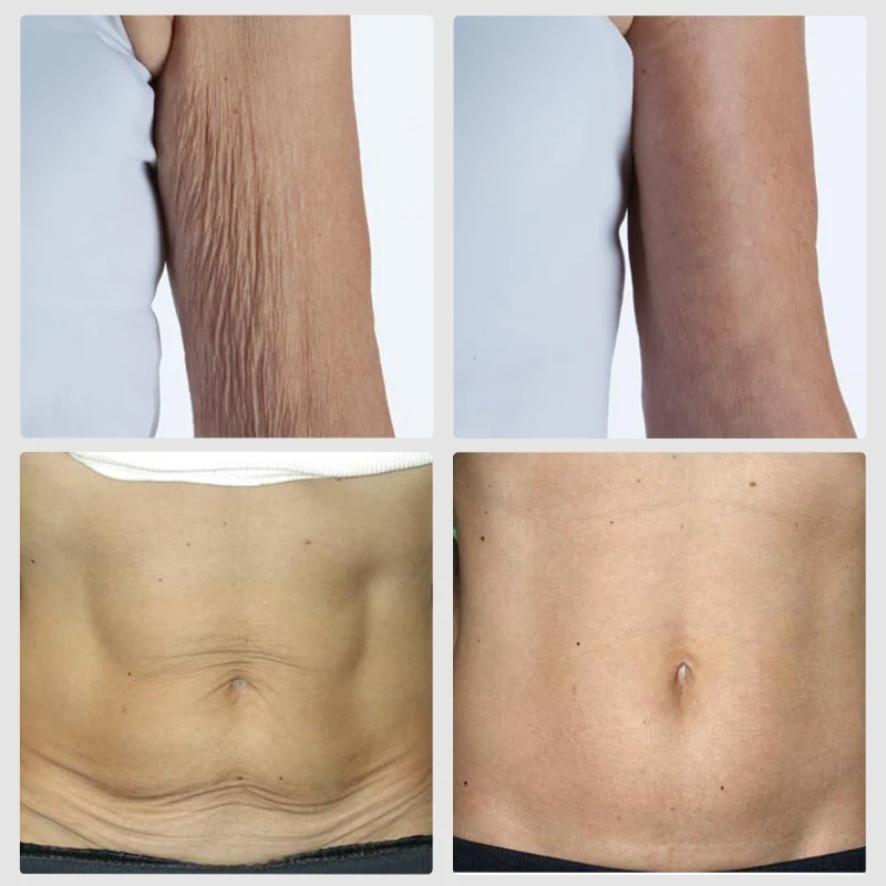 Retinol Vitamin E Body Cream Lifting Tighten Abdominal Shaping Firm Arm Massage Moisturizing Skin Remove Cellulite Care Cream 2