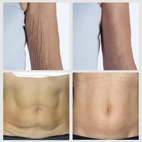 Retinol Vitamin E Body Cream Lifting Tighten Abdominal Shaping Firm Arm Massage Moisturizing Skin Remove Cellulite Care Cream 2