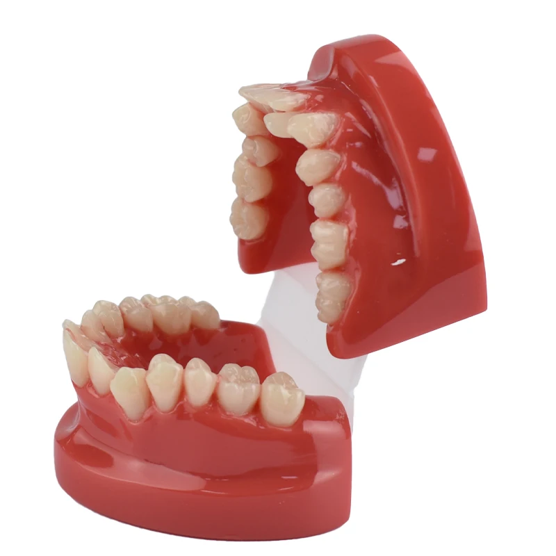 

Dental Teeth Malocclusion Model Training Studying Teaching Dentist Oral 3D Resin Model Demonstration Tools