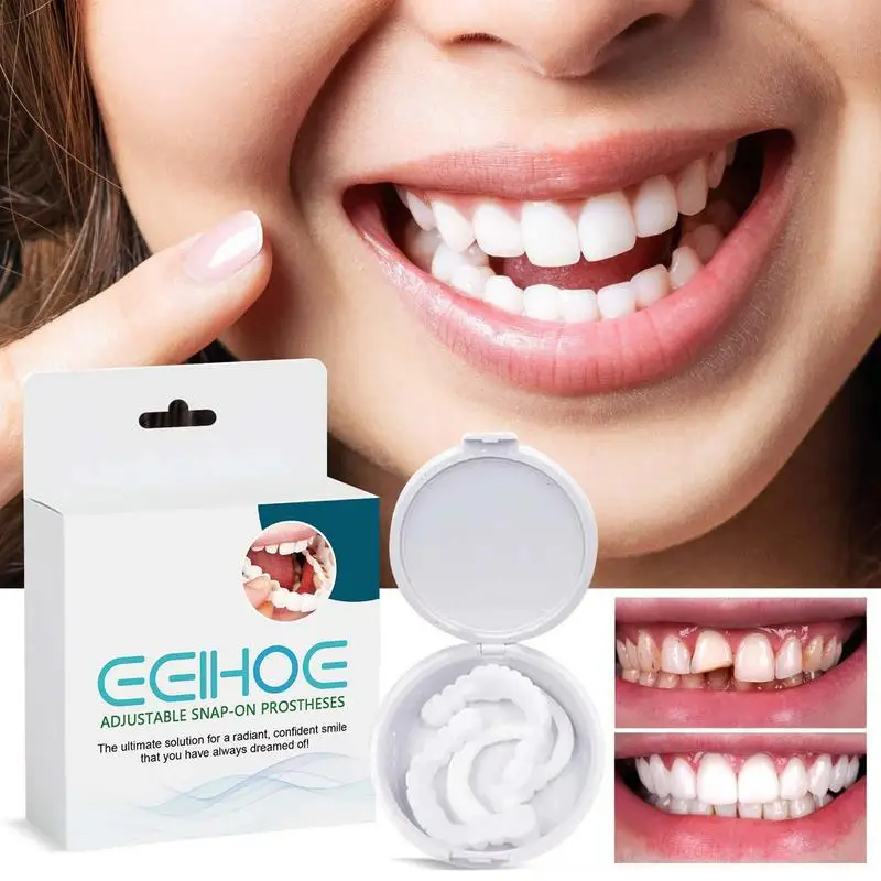 1 Pair Resin Teeth Veneers Repair Kit To Cover Imperfect Teeth Adjustable Snap On Dentures For Temporary Teeth Confident Smile