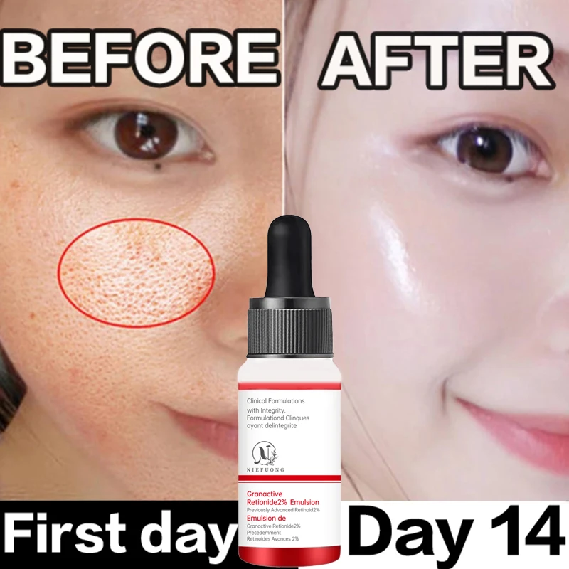 Pore Shrink Face Serum Pore Minimizer Facial Pores Narrowing Serum Pore Contraction Tightens Moisturizer Essence Shrinking Pores pore shrinking serum cleaner remover open pores face cleaning contraction minimizer facial cleansing