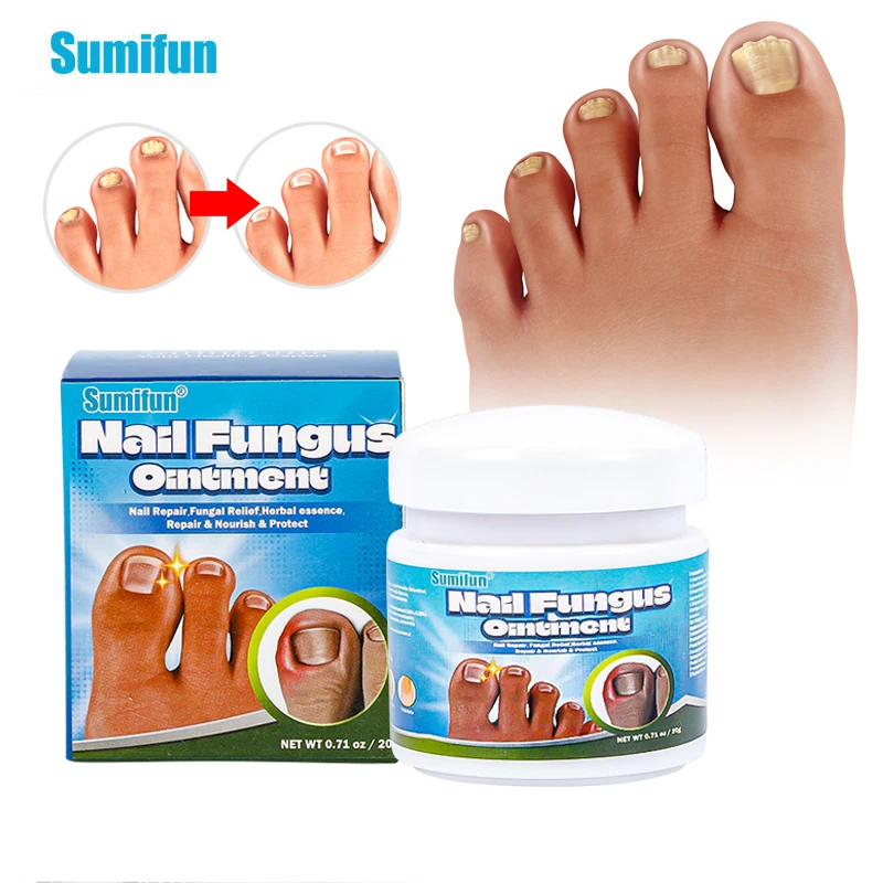 1box Sumifun Nail Fungus Ointment Onychomycosis Paronychia Treatment
