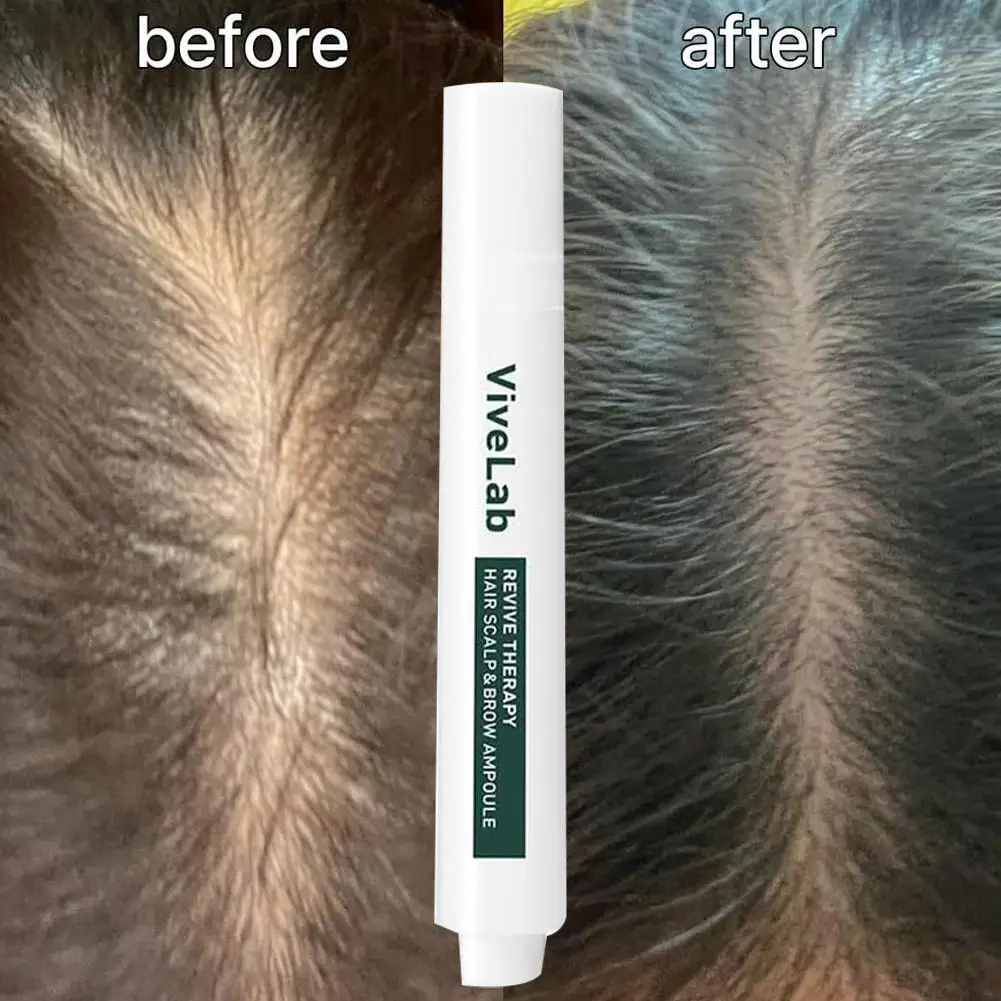 15 مللي مصل فروة الرأس والشعر لتخفيف الشعر مضاد لت...