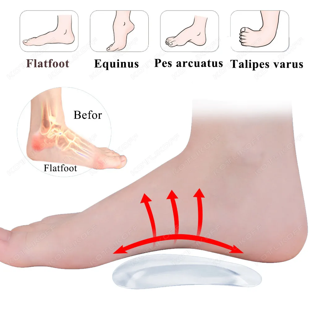 Orthesenbogen Fußpflege Komfort Schmerzen Silikon Orthopädische Einlegesohlen für Schuhe Frauen Plattfüße Fußgewölbeunterstützung Selbstklebende Fußpolster – Detail 5