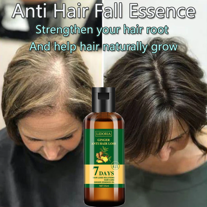 

Natural Hair Growth Ginger Essential Oil Effective Prevent Baldness Serum Regrowth Thicker Hair Anti-loss Hair Product Men Women