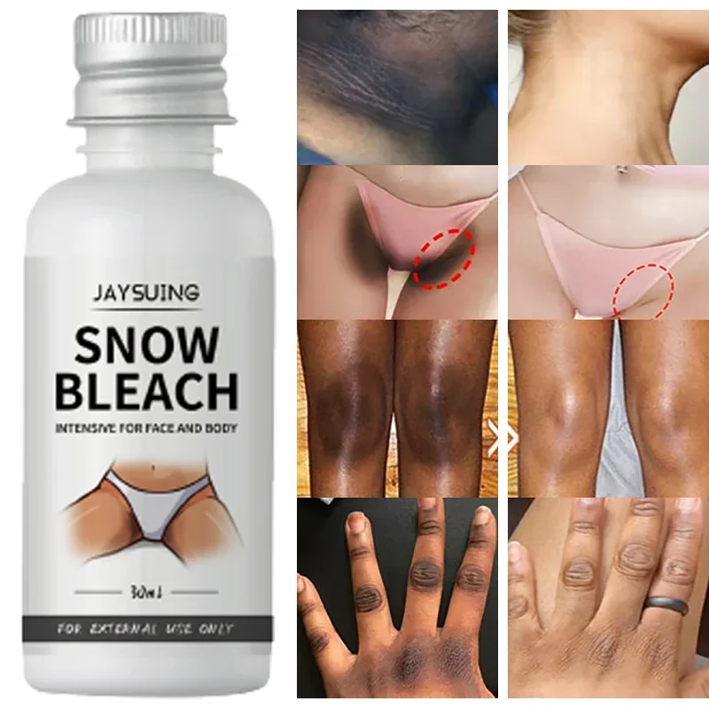 Whitening Cream For Dark Skin Armpit Thigh Inner Joint Lightening Intimate Area Underarm Body Care Private Parts Brighten Lotion whitening lotion