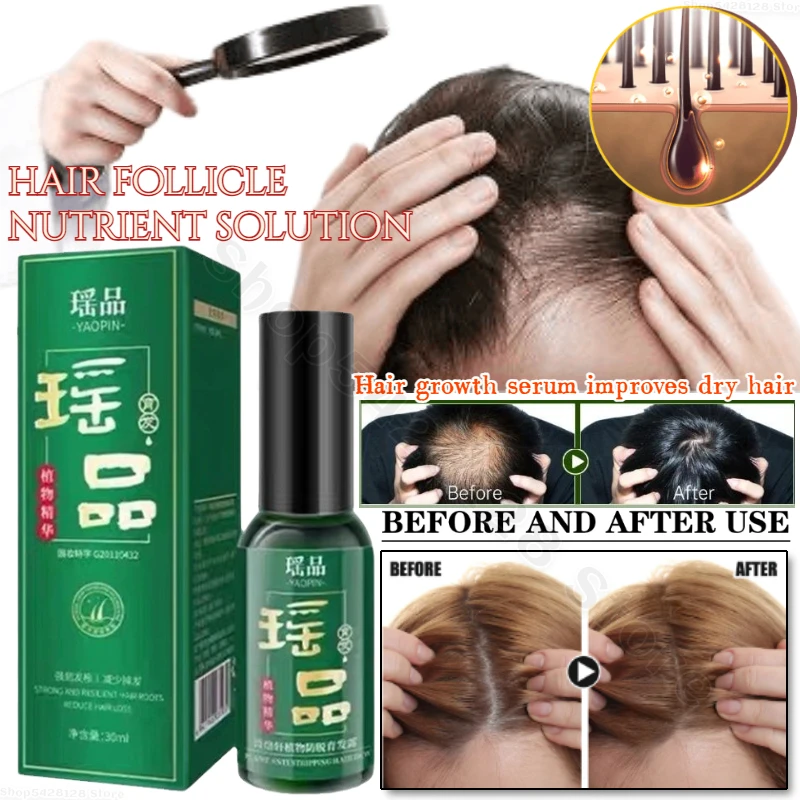 

Быстрое масло для роста волос эссенция для восстановления волос филировка лечение жидкость для роста против выпадения волос уход для мужчин и женщин
