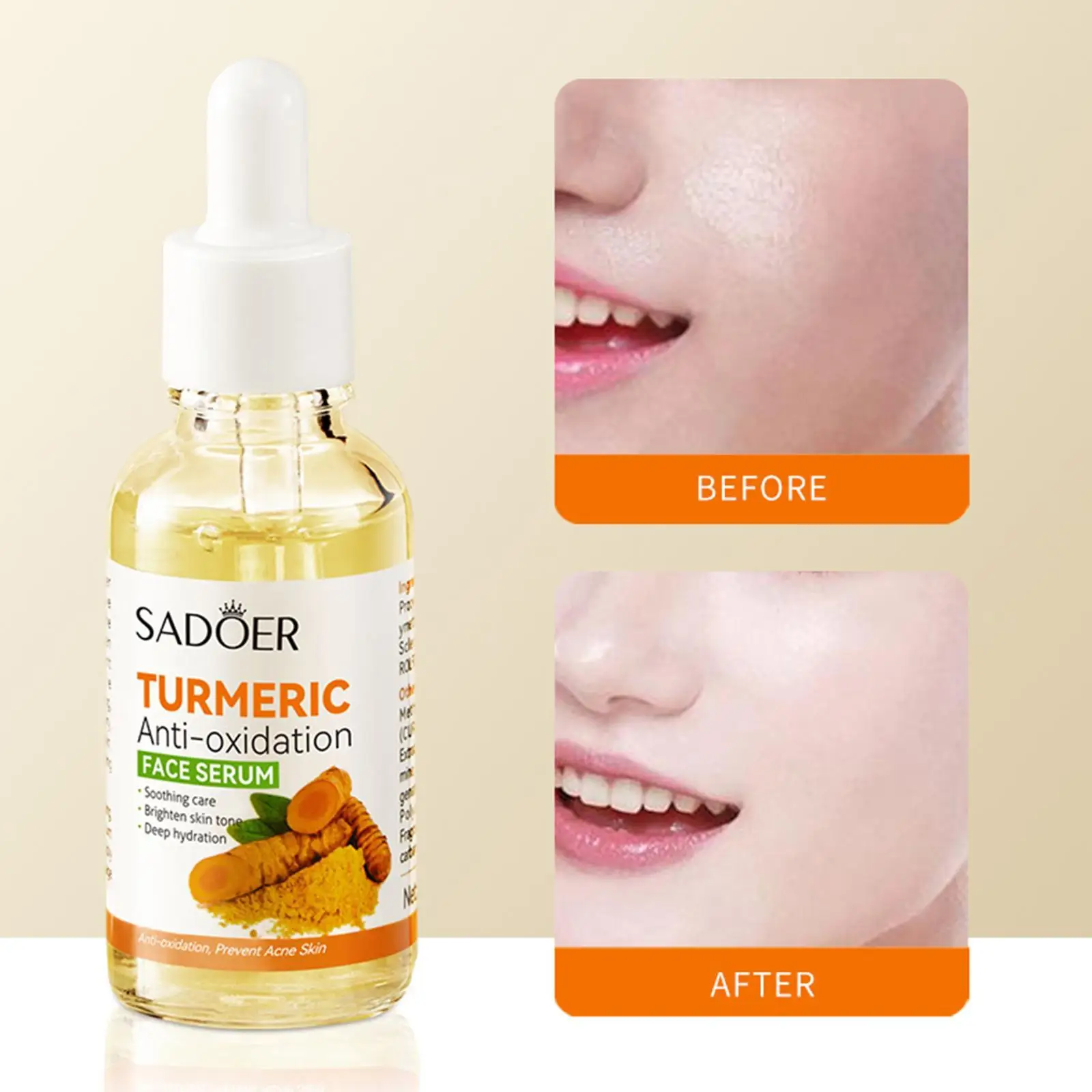 30ml Turmeric Antioxidation Face Serum Freckle Dark Spots Removal Anti