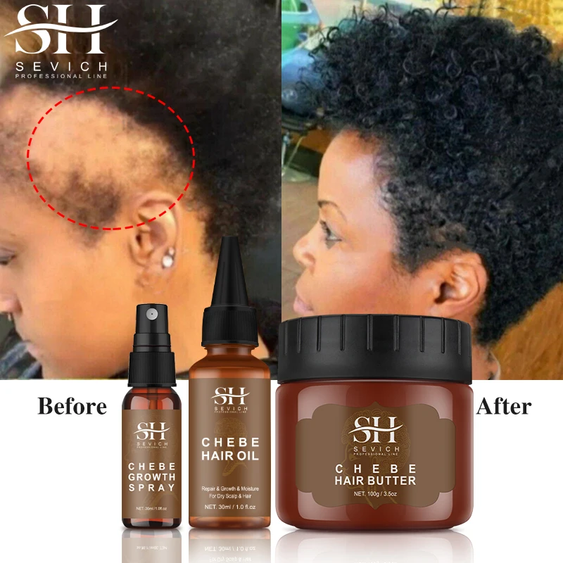 African Hair Growth Spray Anti Hair Loss Treatment Oil Traction Alopecia Chebe Powder Fast Edges Hair Growth Strengthener Oil warm scalp african scientific name croton gratissimus traditional chebe powder hair oil rich nutrition