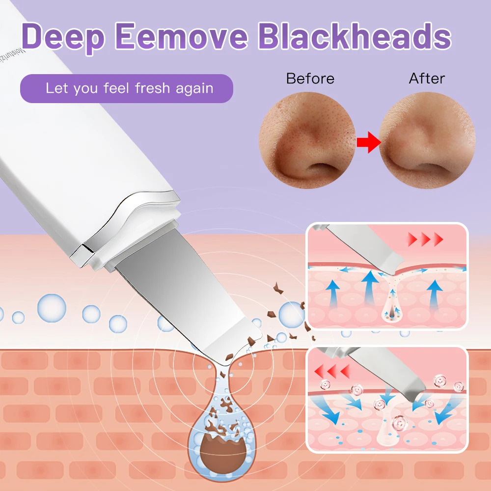 Ultrasonic Peeling Machine Skin Care Blackhead Remover Device Face Cleaning Pore Cleanser Facial Lifting Massager Skin Scrubber 5