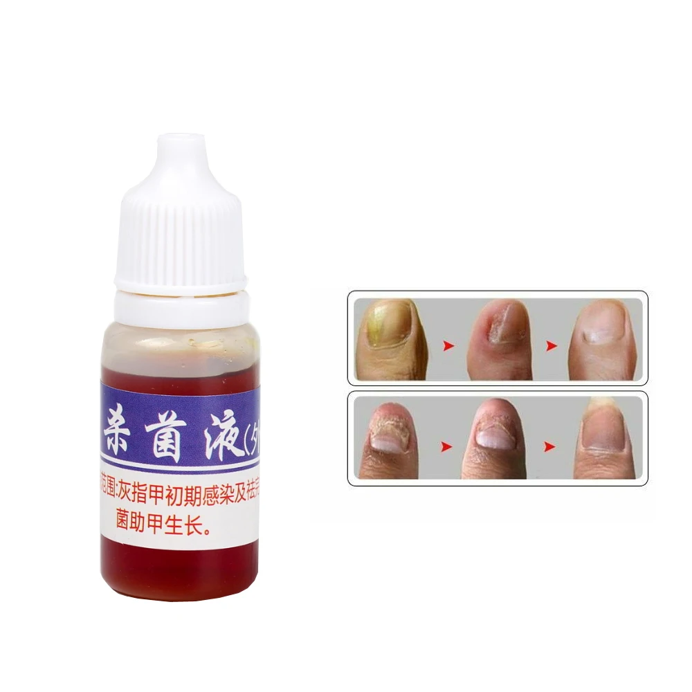 Nail Fungus Remover Anti Infection Fungal Nail Treatment Liquid Gel