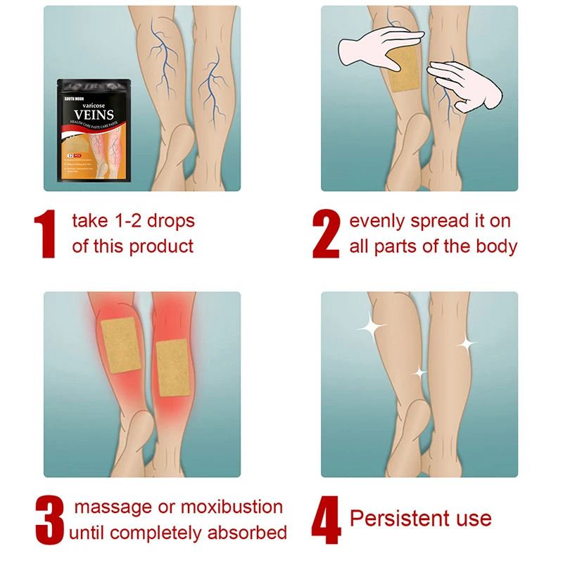 South Moon Varicose Veins Phlebitis Spider Earthworm Leg Relief Patch Anti Swelling for Foot Health Care Removal Pain 12pcs