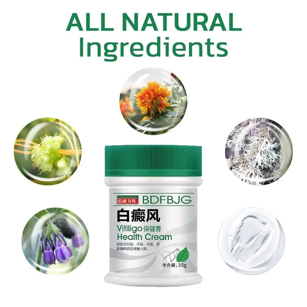 Natural TreatVitiligo Soothing Cream Skin Care Improve Skin Discoloration Vitiligo Care Cream Fast Penetration Fast Soothing