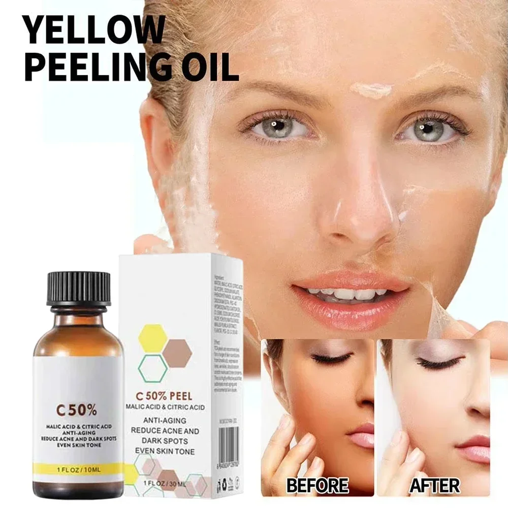 50% Chemical Peel Peel Acid Skin Superforce Pigmentation Lightening Melanin Acne Treatment Remove Scar facial peel kit