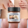 Chicken Skin Removing&Cuticle Removing Smooth&Tender Skin Moisturizing lotion Body Cream Chicken Skin Removing Leg Beauty Cream 1