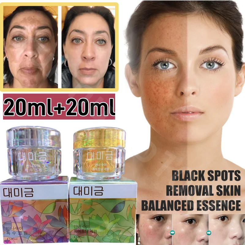 

Strong Bleaching Whitening Face Freckles Remove Corrector Cream Anti-freckle Herbal Whitening Brighten and Moisturizing Set