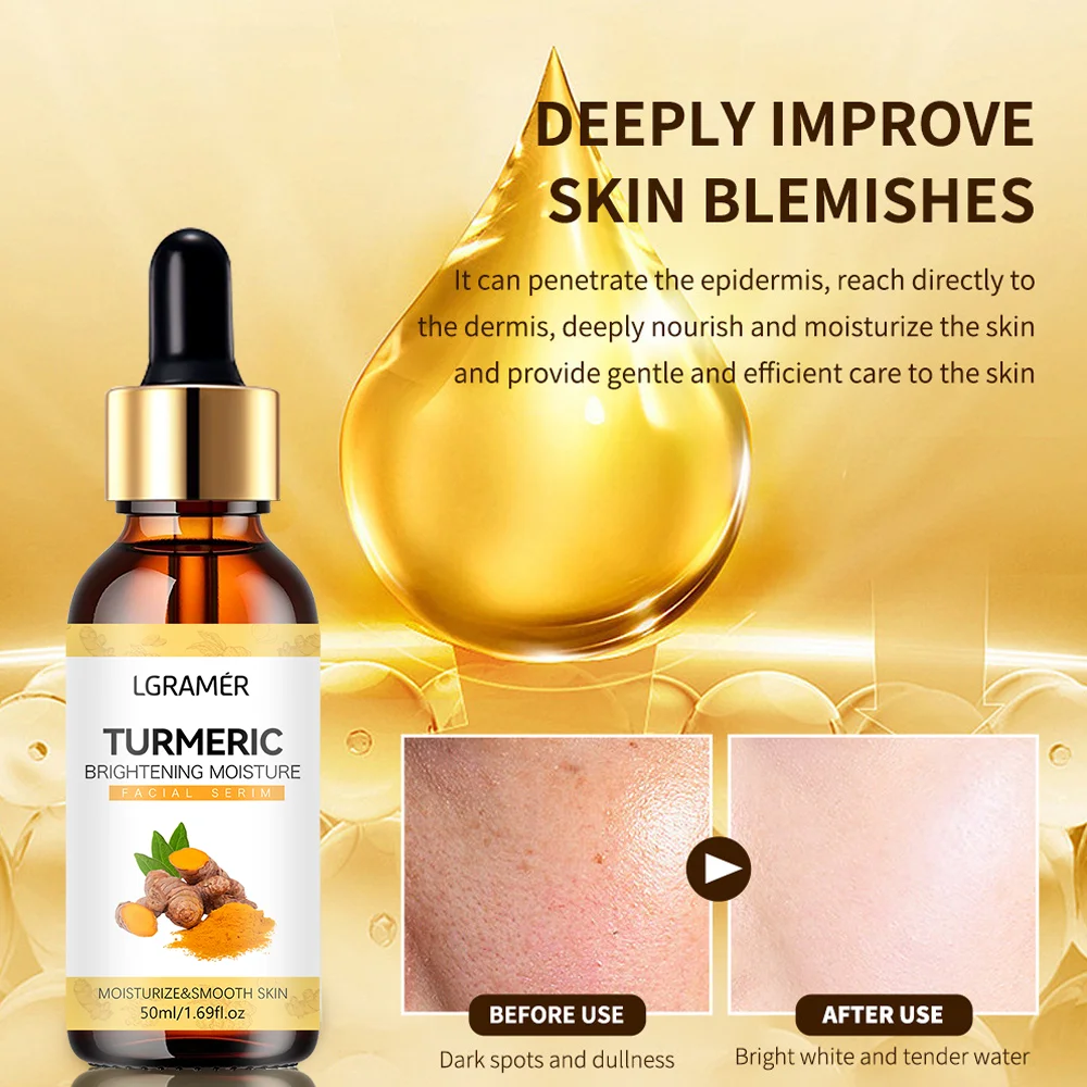 Turmeric Freckle Whitening Serum Anti-oxidant Nourishing Moisturizing Repair Skin Brighten Fade Dark Spot Essence Face Care 5