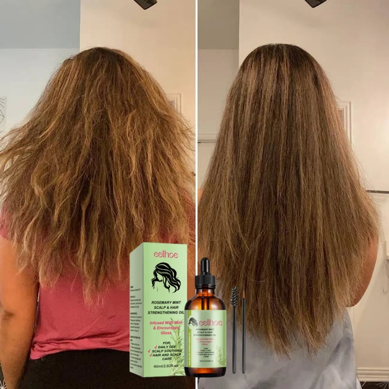 Rosemary Hair Care Essential Oil Anti hair loss Serum Repairs And Restores Hair Health.Improveing Texture,Elasticity,Gloss
