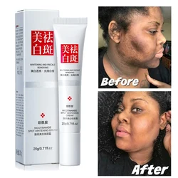 Effective Whiten Cream Brighten Face For Face Spots Remove Dark Spot Melasma Anti-pigmentation Improve Dullness Skin Care Cream