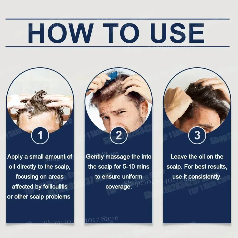 Reduces Hair Fall Nourishes the Scalp Powerful Hair Growth Serum Strengthens hair and adds shine Deeply moisturizes & nourishes