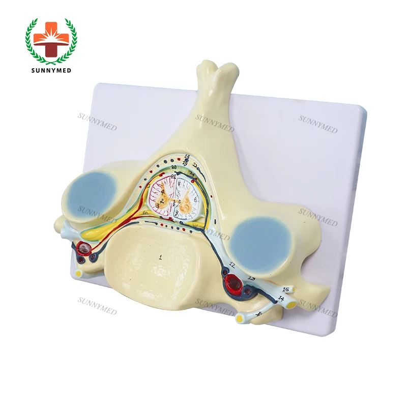 

SY-N028 good technology medical Anatomy Model Spinal cord transection Model with Nervous System