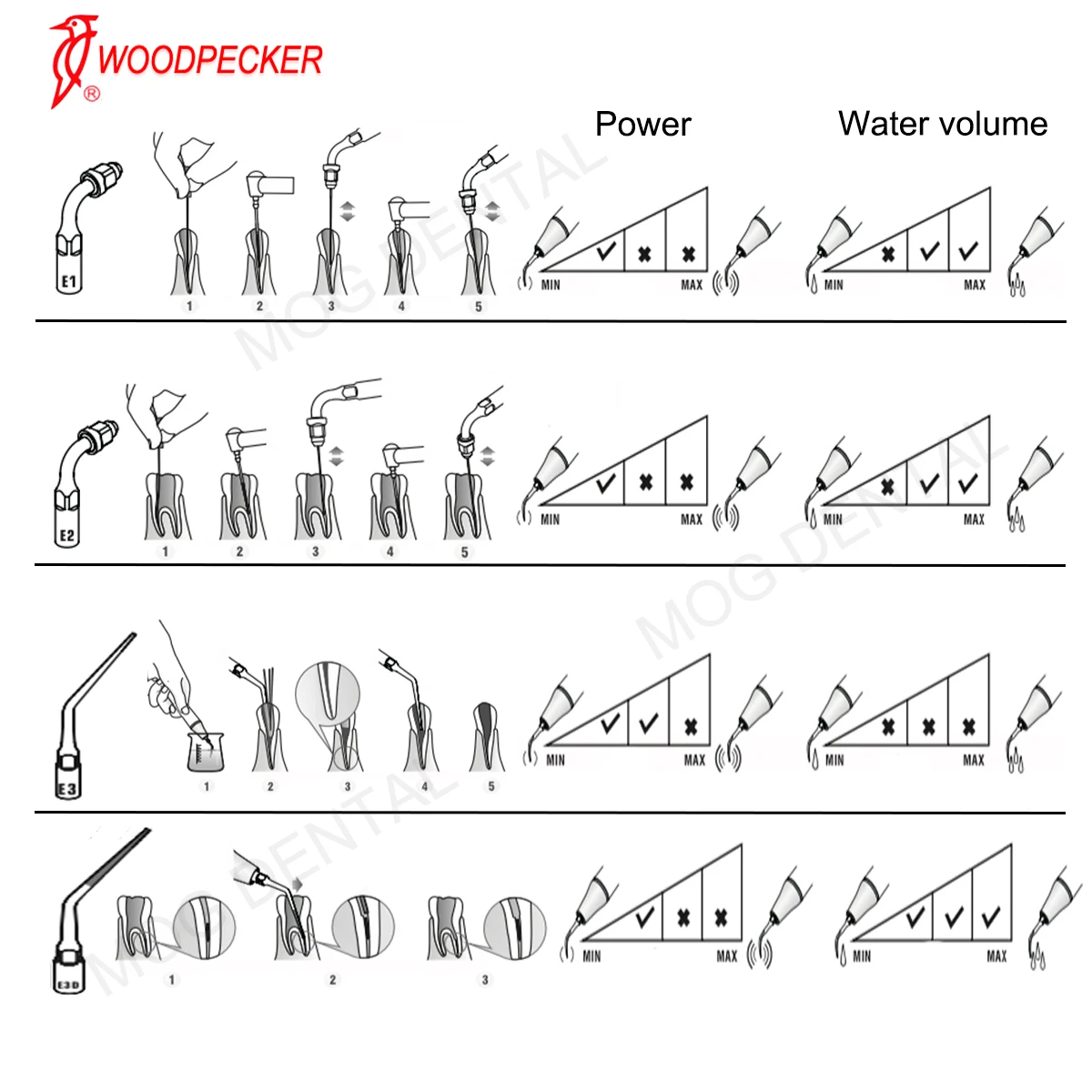 Woodpecker Dental Ultrasonic Perio Scaler Tips Dentist Tools Root Canal Endodontics E-Series Fit EMS UDS Scaler Handpiece 4