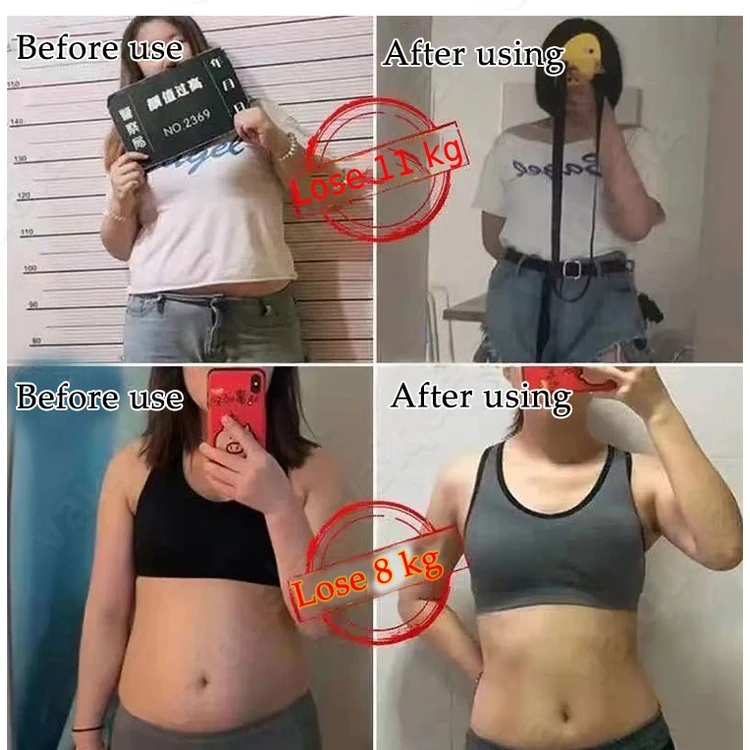 Slimming Navel Sticker 30Pcs/Box Weight Lose Products Fat Burning Patches weight loss products
