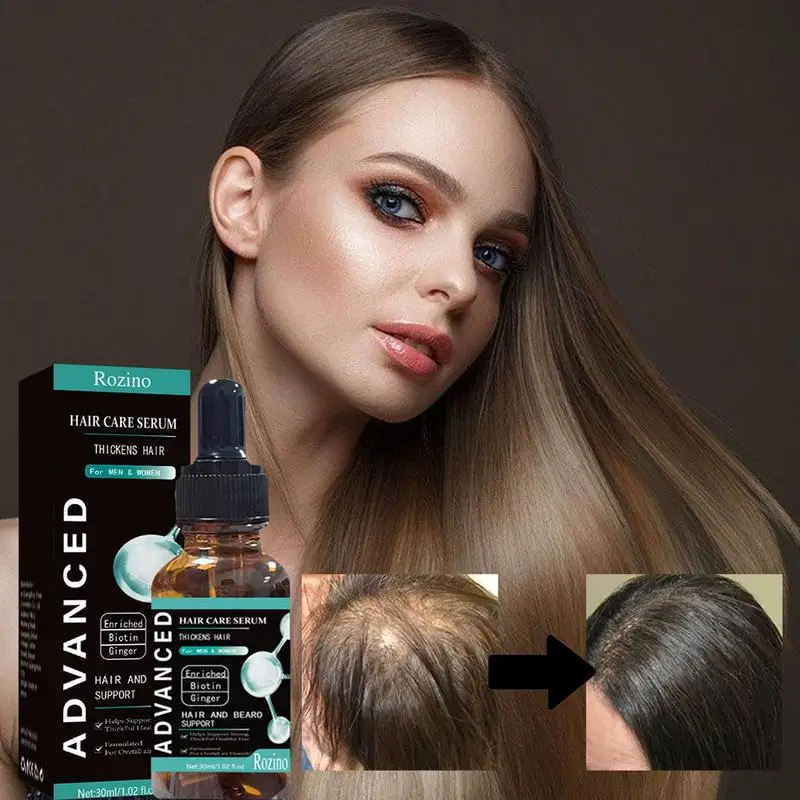 

Biotin Oil Organic Natural Hair Growth Essence High Potency Vitamin B Anti Hair Loss Scalp Treatments Beauty Health Hair Care