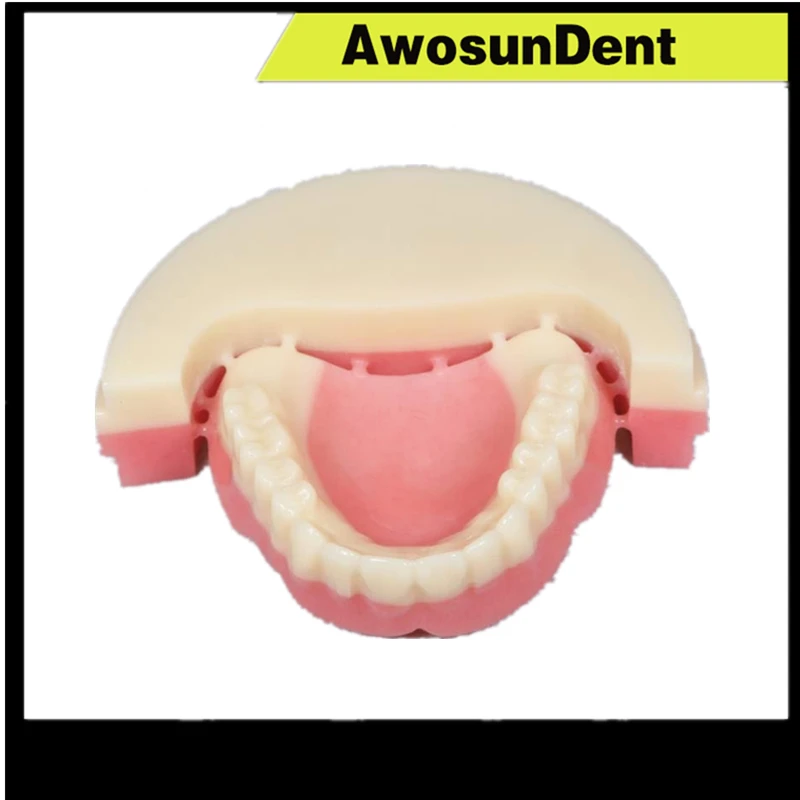 Pmma Full Denture | Pink Cad Cam Disc | Pmma Pmma Blocks | Denture ...