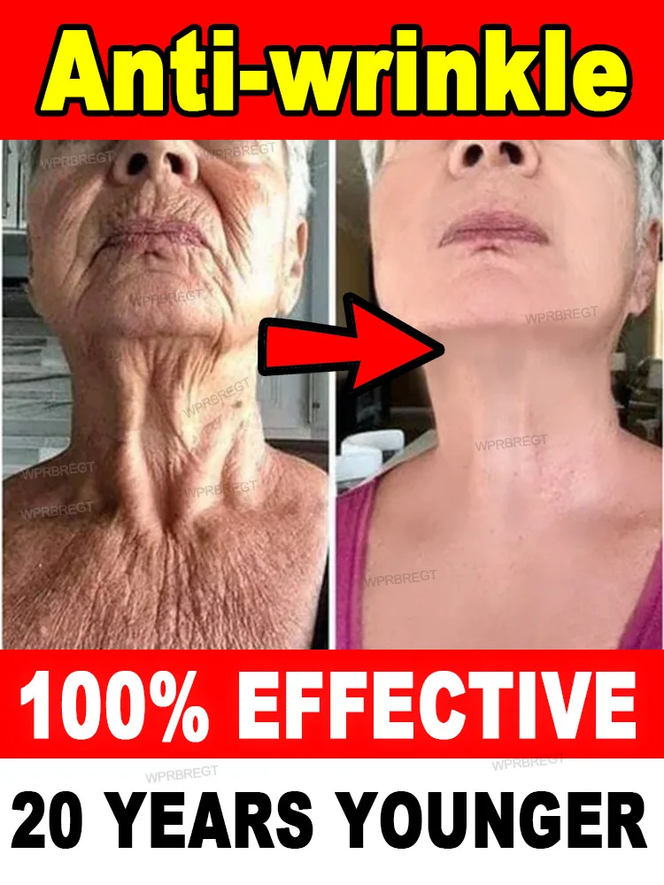 No wrinkles, 20 years younger 1