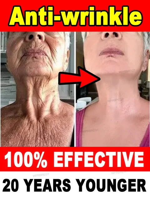 No wrinkles, 20 years younger 1