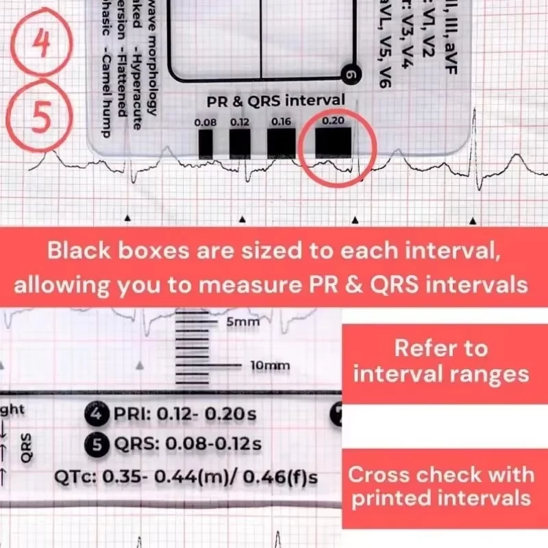 Ecg 7 Step Ruler 7 Step Scale for Ecg Observation Portable Transparent 7step Ruler Measurement Tool for Interpretation measurement tool