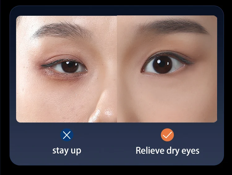 Eye Massage Device 4.5W Cold Hot Compress Dual Type-C Intelligent Visual Display 3-level Adjust Low decibel Relieve Eye Fatigue 7