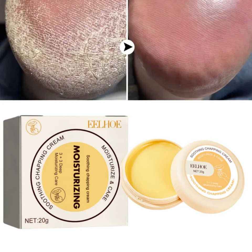 

Foot Treatment Cream Whitening Anti-cracking Feet Dead Skin Removal Moisturize Foot Care Exfoliatin Scrub Anti-dry Beauty Health