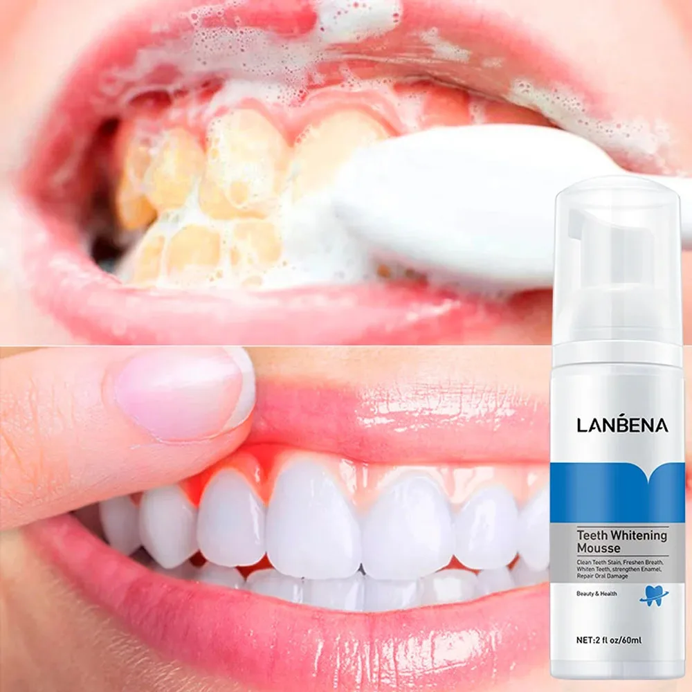

Teeth Whitening Mousse Toothpaste Removing Teeth Stains Dental Calculus Reduce Yellowing Fresh Breath Cleaning Teeth Oral Care