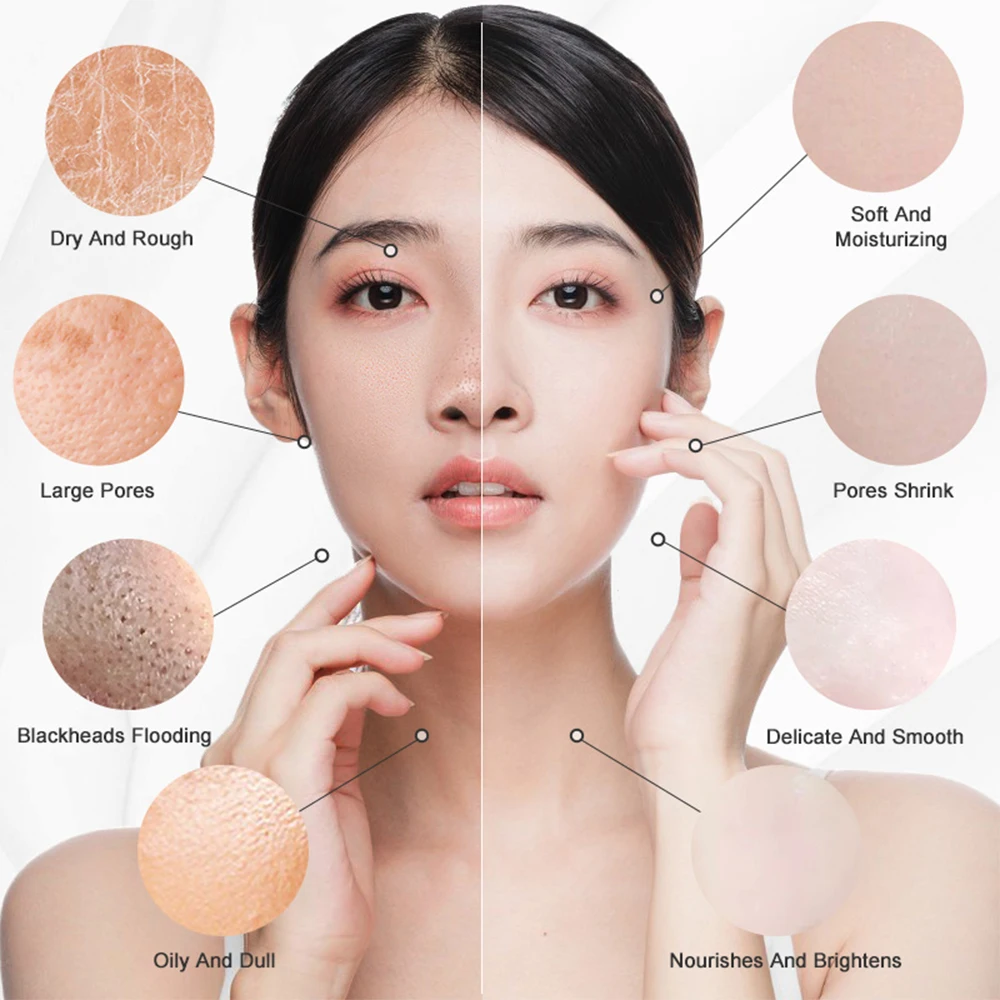 Рисунок 5 - Маска для удаления черных точек на носу