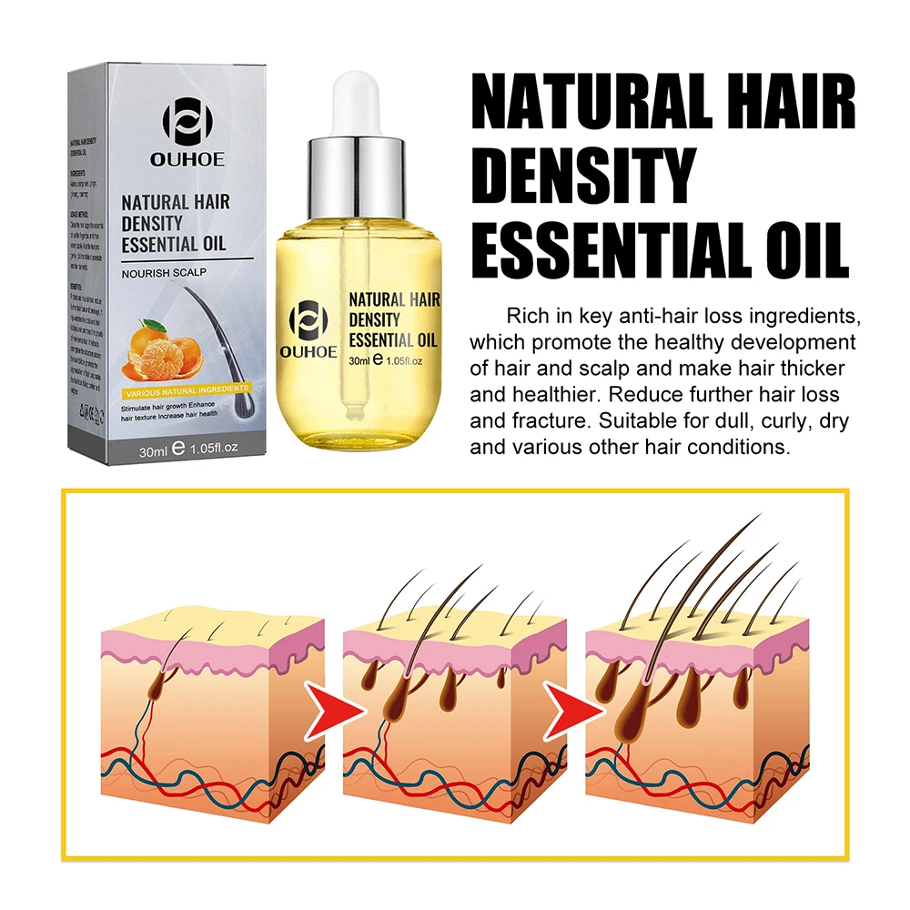 Natural Hair Growth Essential Oil Ginger Essence Hair Regrowth Thicken Treatment Anti Loss Gift Set For Men Women
