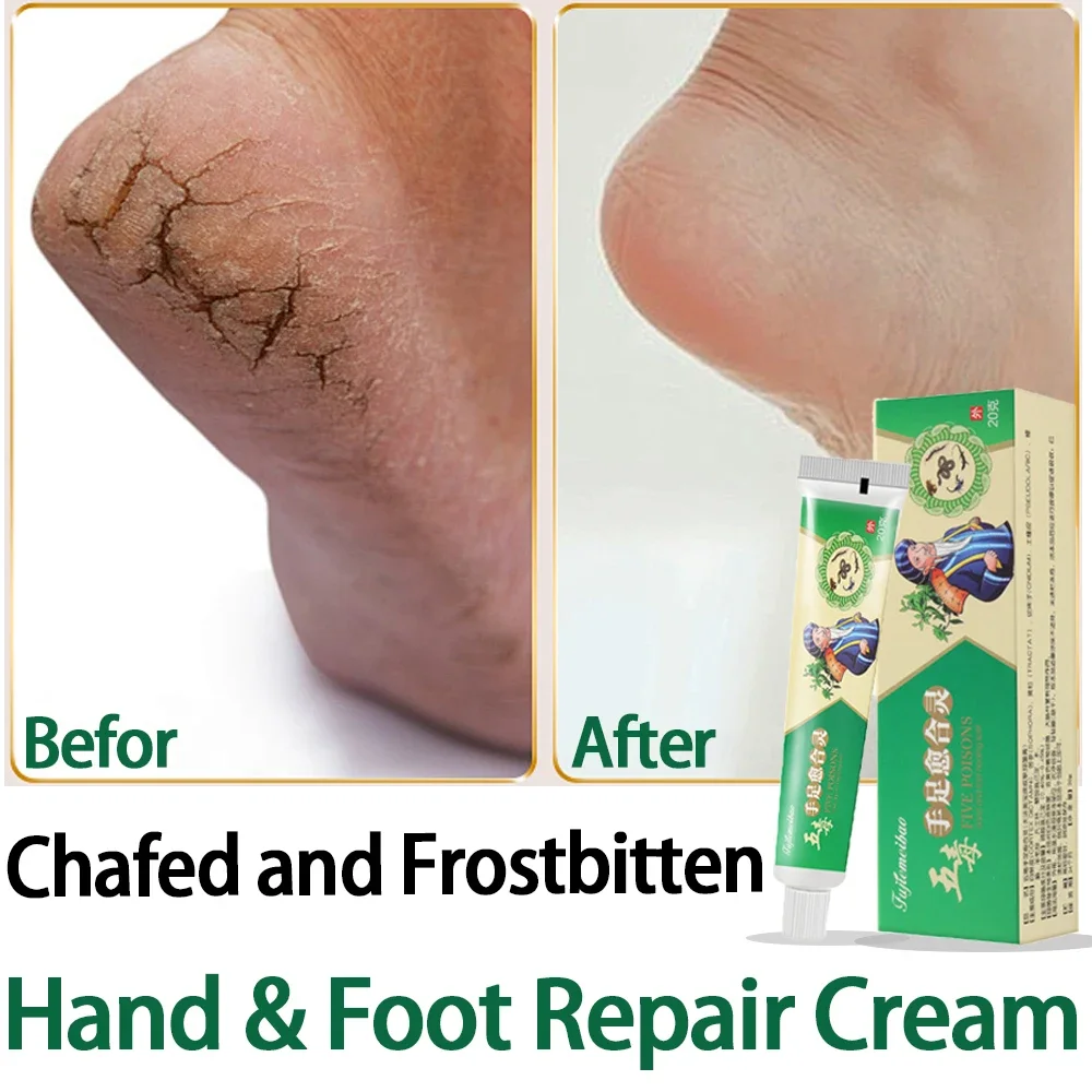 Herbal Anti-Crack Frostbite Foot Cream Oil Anti-Drying Crack Feet Cream Heel Cracked Repair Removal Dead Skin Moisturizing