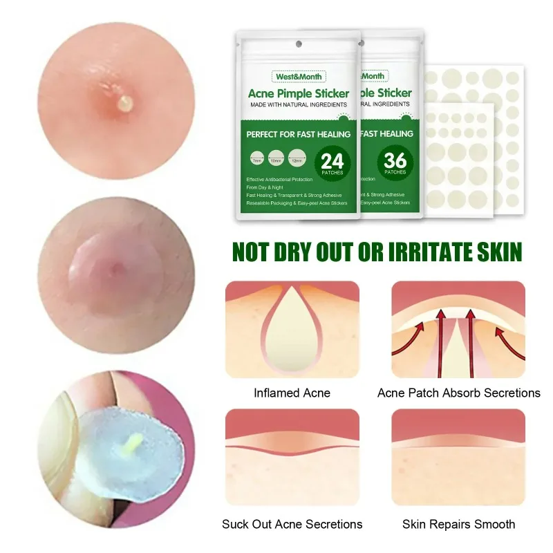 Acne pimple patch blackhead remover acne remover invisible waterproof absorb pus acne pimple remover tool cleaner Korean skin care product