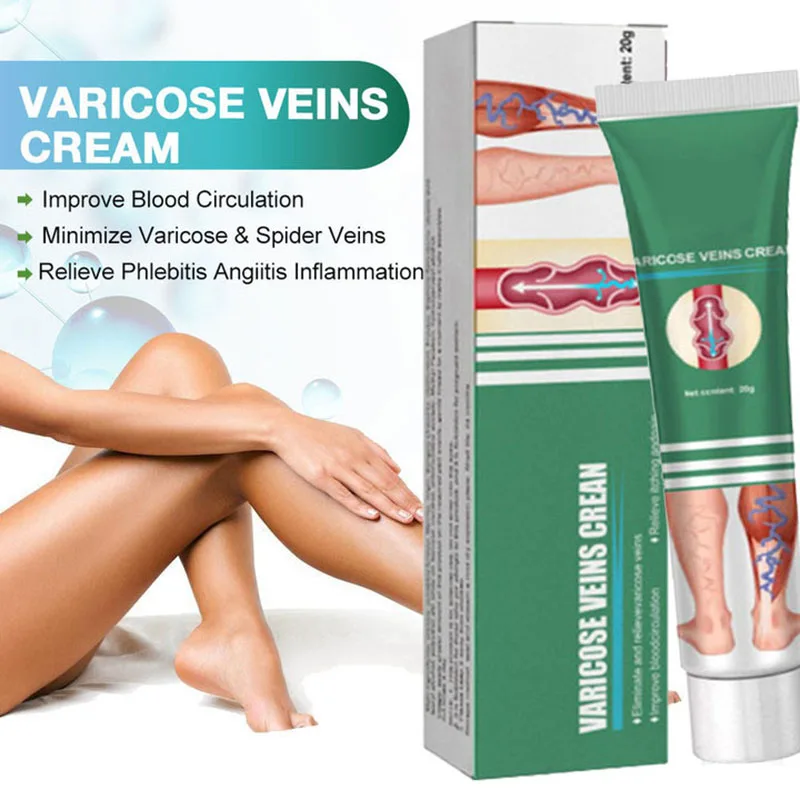 Pomada para varizes Creme eficaz al&iacute;vio das veias varicosas para alitivar a vasculite flebite aranha dor tratamento
