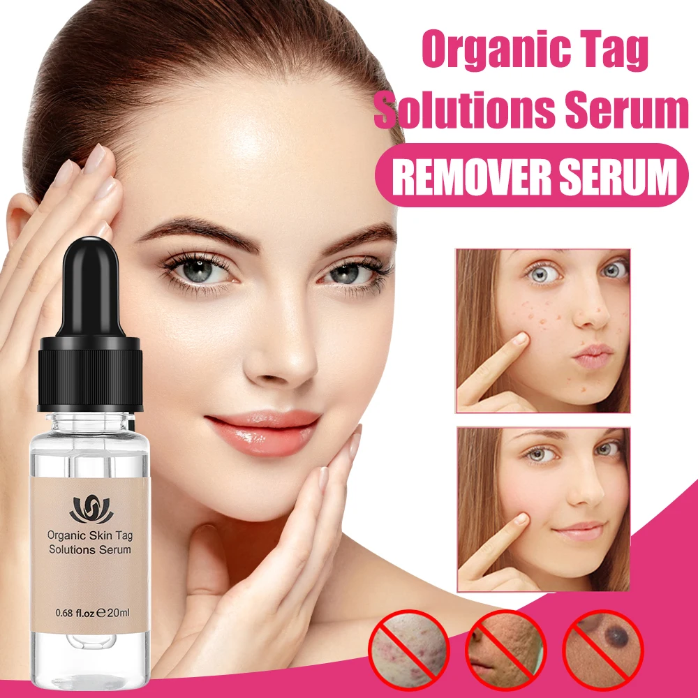 Face Clean Pore Vacuum Blackhead Remover Skin Care Acne Pimple Removal